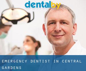 Emergency Dentist in Central Gardens