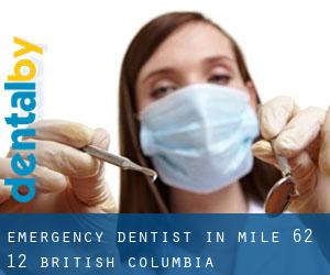 Emergency Dentist in Mile 62 1/2 (British Columbia)