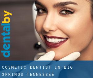 Cosmetic Dentist in Big Springs (Tennessee)