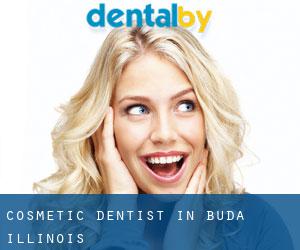 Cosmetic Dentist in Buda (Illinois)