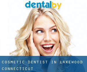 Cosmetic Dentist in Lakewood (Connecticut)