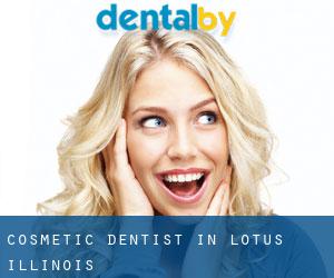 Cosmetic Dentist in Lotus (Illinois)