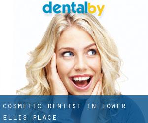 Cosmetic Dentist in Lower Ellis Place