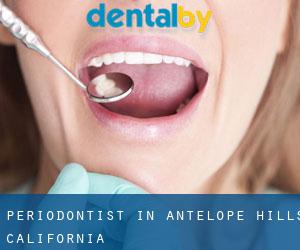Periodontist in Antelope Hills (California)