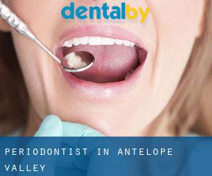 Periodontist in Antelope Valley