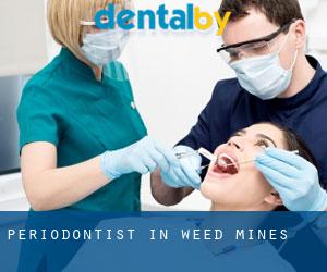 Periodontist in Weed Mines