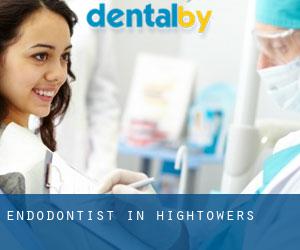 Endodontist in Hightowers