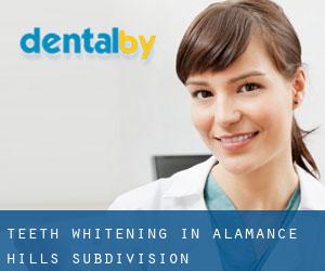 Teeth whitening in Alamance Hills Subdivision