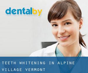Teeth whitening in Alpine Village (Vermont)
