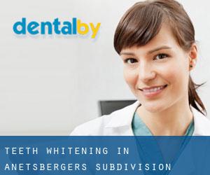 Teeth whitening in Anetsberger's Subdivision