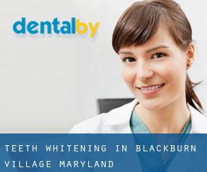Teeth whitening in Blackburn Village (Maryland)