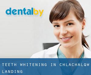 Teeth whitening in Chł'ach'alqw Landing