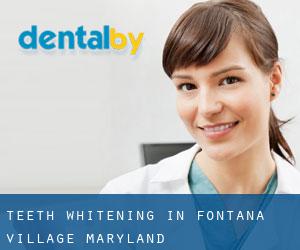 Teeth whitening in Fontana Village (Maryland)