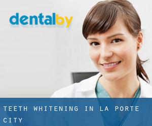 Teeth whitening in La Porte City