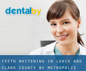 Teeth whitening in Lewis and Clark County by metropolis - page 1